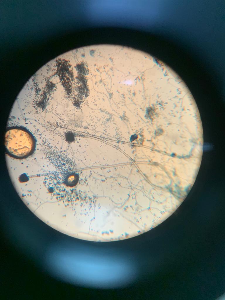 Microbial Identification & Morphological Analysis